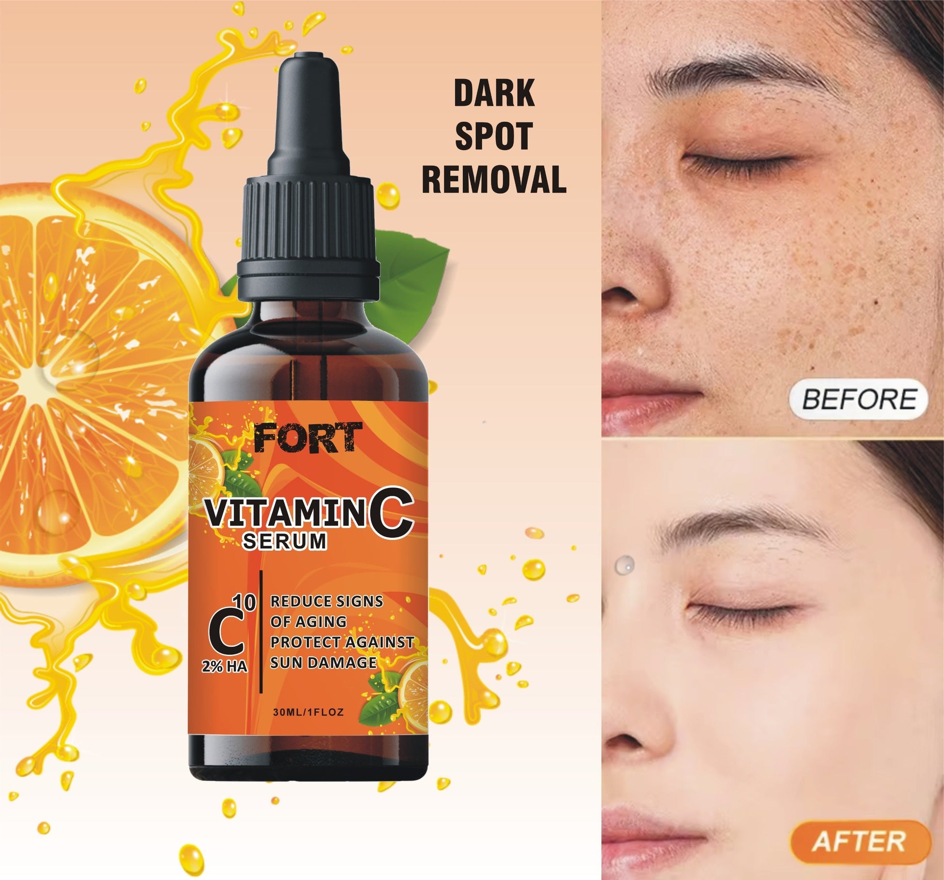 FORT Vitamin C Serum for Face - Anti-Aging, Dark Spot Correcting,