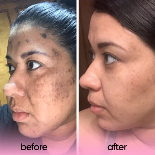 Kojic Acid and Turmeric Cleansing Pads