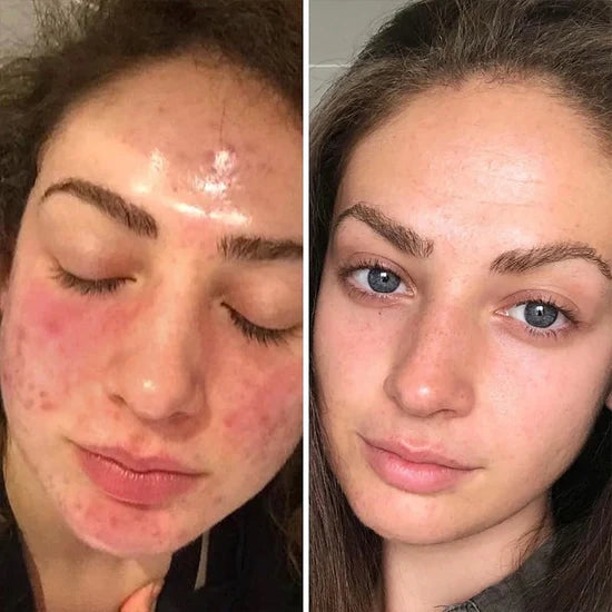 Kojic Acid and Turmeric Cleansing Pads